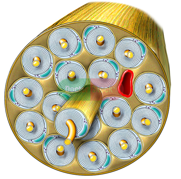 This medical exhibit pictures the anatomy of the a nerve bundle in an enlarged, microscopic view. Visible structures include the epineurium, endoneurium and perinerium. This graphic is intentionally left unlabeled to accommodate custom label requests.