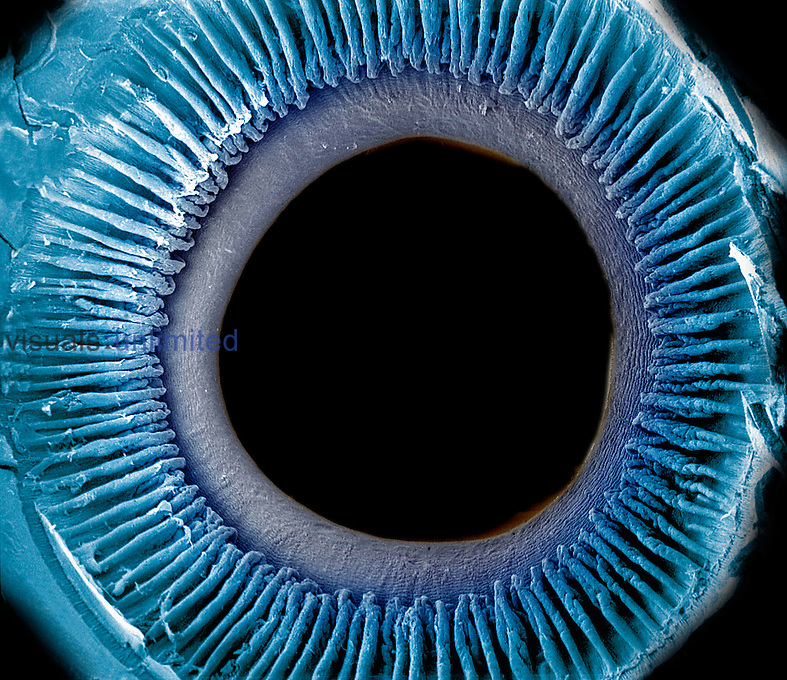 Eye showing the inner surface of the iris, pupil, and ciliary processes. The lens was removed to show the posterior surface of these structures. The iris regulates the amount of light that enters the pupil by changing its size and it is what gives the eye its color. SEM **On Page Credit Required**