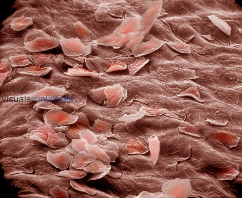 Highly flattened cells typical of protective stratified squamous epithelium cells that line the inner vaginal surface. These epithelial cells are continuously shed by the process of dequamation and are replaced by division of generative cells in the basal layer of epithelium. SEM X405 **On Page Credit Required**